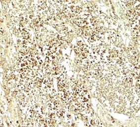 Anti-E2F3 antibody used in IHC (Paraffin sections) (IHC-P). GTX31589