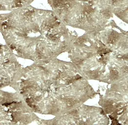 Anti-CRBN antibody used in IHC (Paraffin sections) (IHC-P). GTX31611