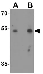 Anti-PDI antibody used in Western Blot (WB). GTX31623