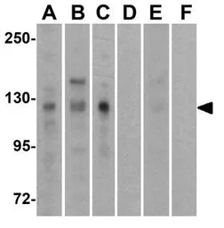 Anti-ADAM17 antibody used in Western Blot (WB). GTX31632