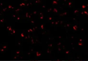 Anti-ASK1 antibody used in Immunocytochemistry/ Immunofluorescence (ICC/IF). GTX31637