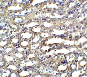 Anti-ICAD antibody used in IHC (Paraffin sections) (IHC-P). GTX31639