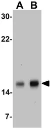 Anti-Survivin antibody used in Western Blot (WB). GTX31651