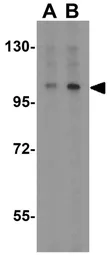 Anti-MTBP antibody used in Western Blot (WB). GTX31662
