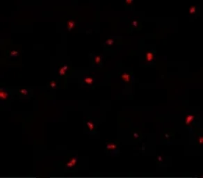 Anti-PAK6 antibody used in Immunocytochemistry/ Immunofluorescence (ICC/IF). GTX31672