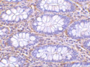 Anti-PAK4 antibody used in IHC (Paraffin sections) (IHC-P). GTX31673