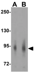 Anti-TLR4 antibody used in Western Blot (WB). GTX31675