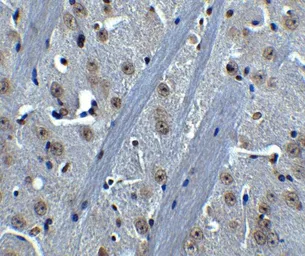 Anti-BTK antibody used in IHC (Paraffin sections) (IHC-P). GTX31694