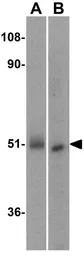 Anti-IRF3 antibody used in Western Blot (WB). GTX31695