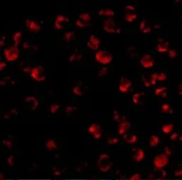 Anti-Bim antibody used in Immunocytochemistry/ Immunofluorescence (ICC/IF). GTX31697