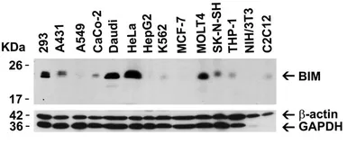 Anti-Bim antibody used in Western Blot (WB). GTX31697