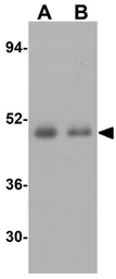 Anti-Caspase 5 antibody used in Western Blot (WB). GTX31700