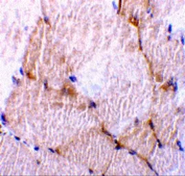 Anti-Caspase 7 antibody used in IHC (Paraffin sections) (IHC-P). GTX31705