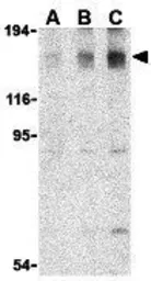 Anti-ASK1 antibody used in Western Blot (WB). GTX31727