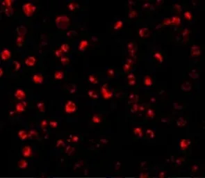 Anti-ATF6 antibody used in Immunocytochemistry/ Immunofluorescence (ICC/IF). GTX31729
