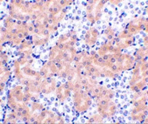 Anti-Bcl2A1 antibody used in IHC (Paraffin sections) (IHC-P). GTX31739