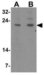 Anti-Bcl2A1 antibody used in Western Blot (WB). GTX31739
