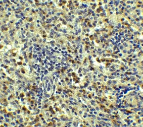 Anti-SQSTM1 / P62 antibody used in IHC (Paraffin sections) (IHC-P). GTX31795