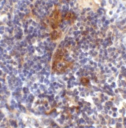 Anti-SQSTM1 / P62 antibody used in IHC (Paraffin sections) (IHC-P). GTX31795
