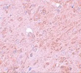 Anti-PIASy antibody used in IHC (Paraffin sections) (IHC-P). GTX31802