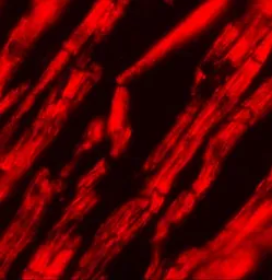 Anti-KPNA2 antibody used in IHC (Paraffin sections) (IHC-P). GTX31812