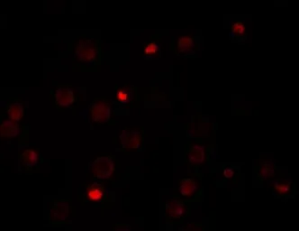 Anti-KPNA4 antibody used in Immunocytochemistry/ Immunofluorescence (ICC/IF). GTX31813
