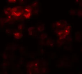 Anti-DYRK2 antibody used in Immunocytochemistry/ Immunofluorescence (ICC/IF). GTX31833