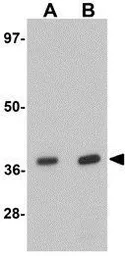 Anti-EI24 antibody used in Western Blot (WB). GTX31841