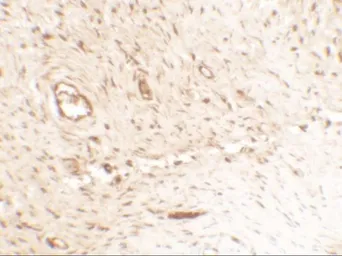 Anti-Osteopontin antibody used in IHC (Paraffin sections) (IHC-P). GTX31886