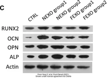 Anti-Osteopontin antibody used in Western Blot (WB). GTX31886