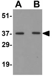 Anti-Osteopontin antibody used in Western Blot (WB). GTX31886