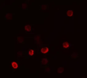 Anti-FLI1 antibody used in Immunocytochemistry/ Immunofluorescence (ICC/IF). GTX31888