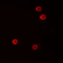 Anti-FHIT antibody used in Immunocytochemistry/ Immunofluorescence (ICC/IF). GTX31890