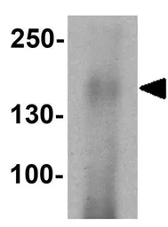 Anti-CFTR antibody used in Western Blot (WB). GTX31913