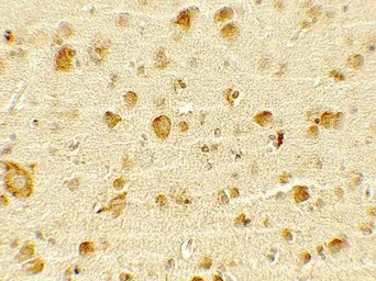 Anti-OLIG1 antibody used in IHC (Paraffin sections) (IHC-P). GTX31916