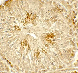 Anti-HDAC2 antibody used in IHC (Paraffin sections) (IHC-P). GTX31925