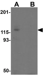 Anti-Nephrin antibody used in Western Blot (WB). GTX31936