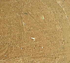 Anti-STEP / PTPN5 antibody used in IHC (Paraffin sections) (IHC-P). GTX31937