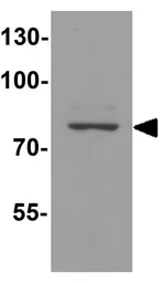 Anti-RHOT1 antibody used in Western Blot (WB). GTX31938