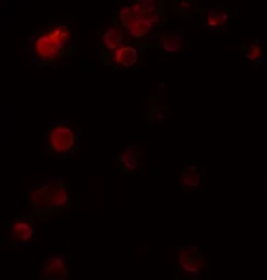 Anti-KIR2DS2 antibody used in Immunocytochemistry/ Immunofluorescence (ICC/IF). GTX31949