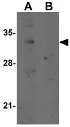 Anti-REEP2 antibody used in Western Blot (WB). GTX31981