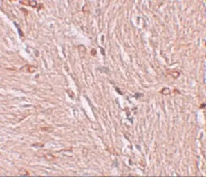 Anti-ZBTB4 antibody used in IHC (Paraffin sections) (IHC-P). GTX31998
