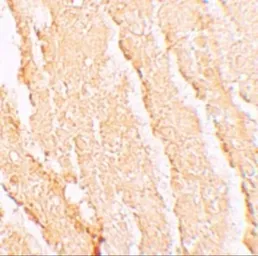 Anti-VPS39 antibody used in IHC (Paraffin sections) (IHC-P). GTX32005