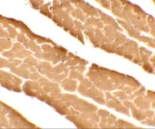 Anti-DDA1 antibody used in IHC (Paraffin sections) (IHC-P). GTX32030