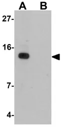Anti-DDA1 antibody used in Western Blot (WB). GTX32030