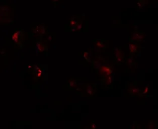 Anti-AFAP1L1 antibody used in Immunocytochemistry/ Immunofluorescence (ICC/IF). GTX32040