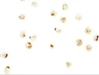 Anti-IRF2BP2 antibody used in Immunocytochemistry/ Immunofluorescence (ICC/IF). GTX32054