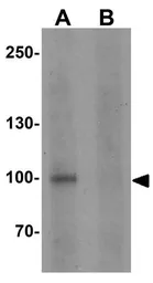 Anti-STOX1 antibody used in Western Blot (WB). GTX32076
