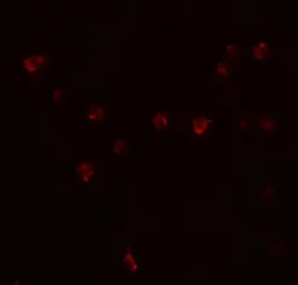 Anti-DDX60 antibody used in Immunocytochemistry/ Immunofluorescence (ICC/IF). GTX32082