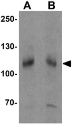 Anti-SCUBE3 antibody used in Western Blot (WB). GTX32089